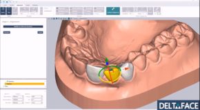 produit Logiciels Deltaface – Aligner