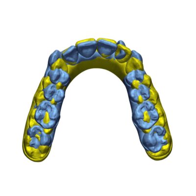 Geomagic Control X aide à faire avancer les traitements orthodontiques