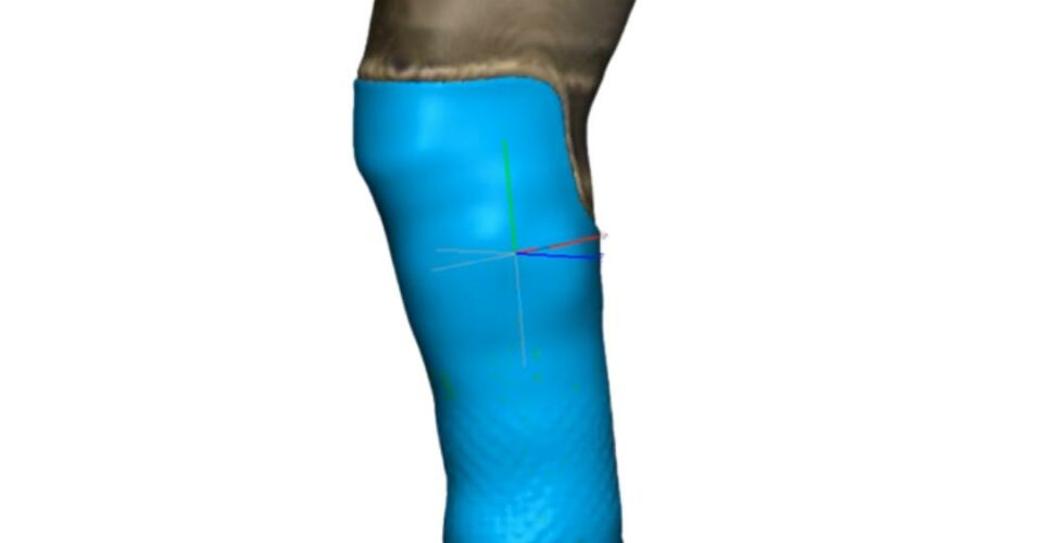 L’innovation numérique en orthétique et prothétique avec Freeform